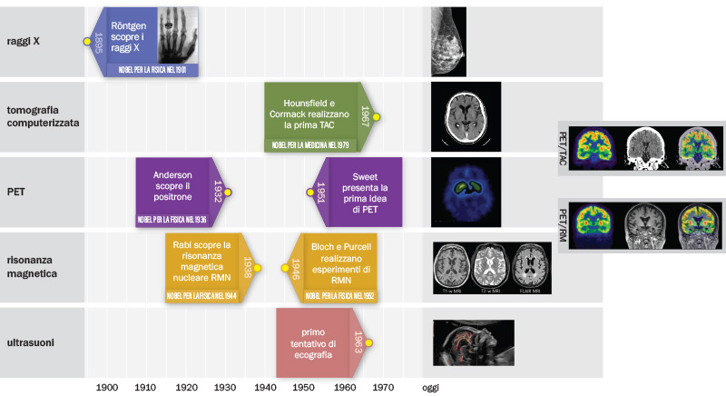 Scoperte di imaging diagnostico